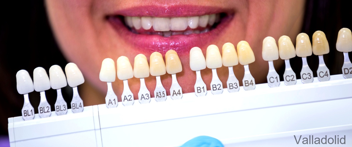 ¿Cuál es el nombre del profesional que realiza implantes dentales?